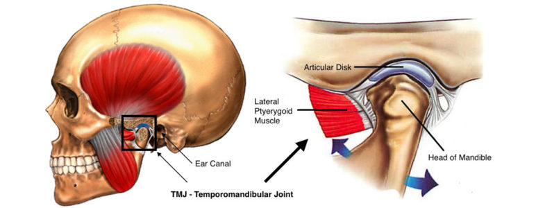 TMJ/TMD Diagnosis and Treatment in Brampton